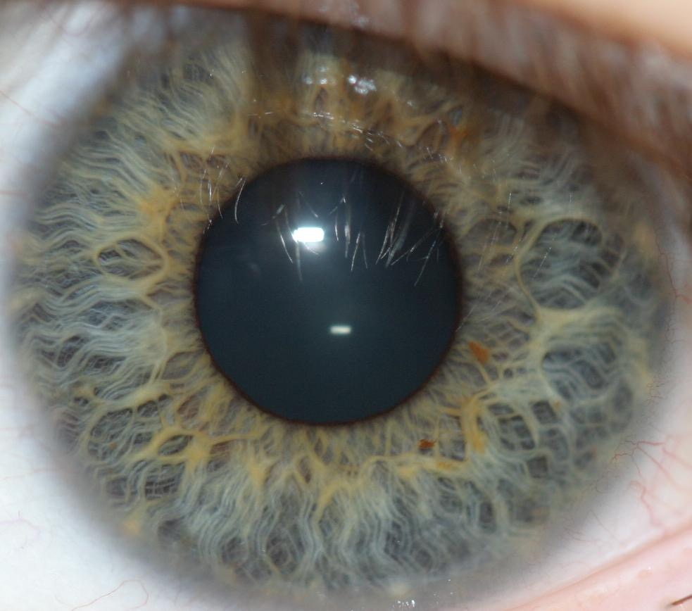 Iris